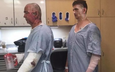 Roosevelt Fire: The Two Hunters Who Were Nearly Burned Alive