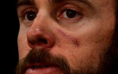 Survivor Describes Hand-to-Claw Combat with Big Cat