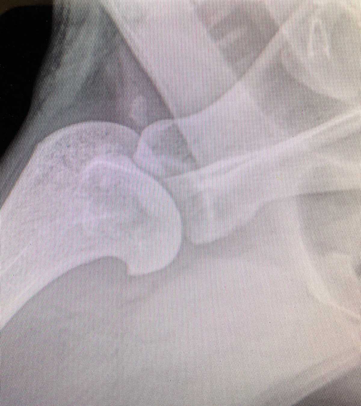 X-ray of bird dog with shoulder arthritis.